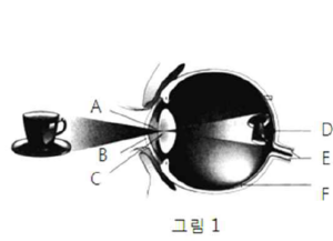 기출문제 그림 5